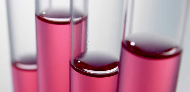 blood tests being analysed